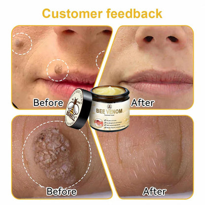 🐝 ما هو "إكسير بشرة النحل"